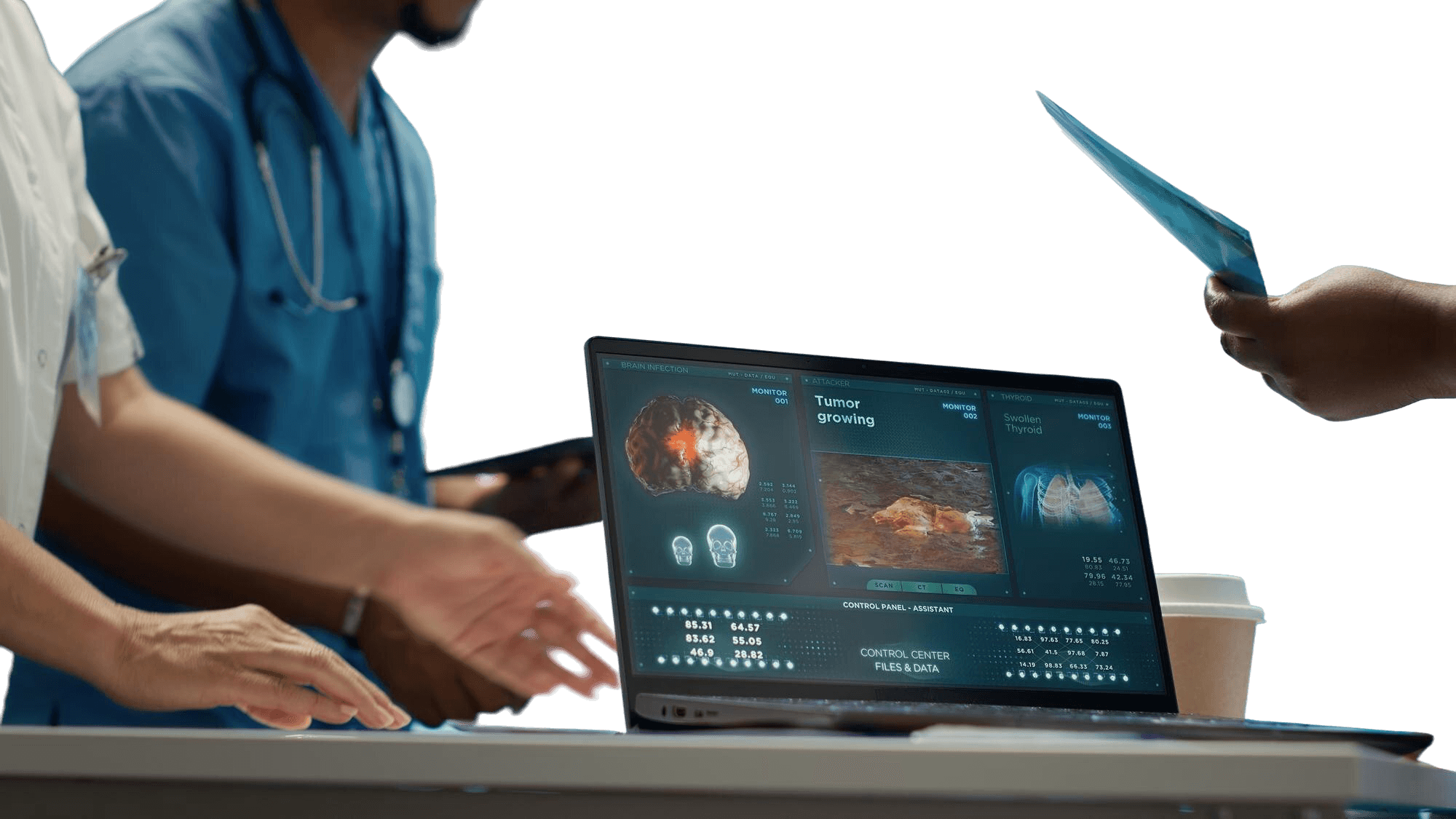 Care team reviewing scans on screen